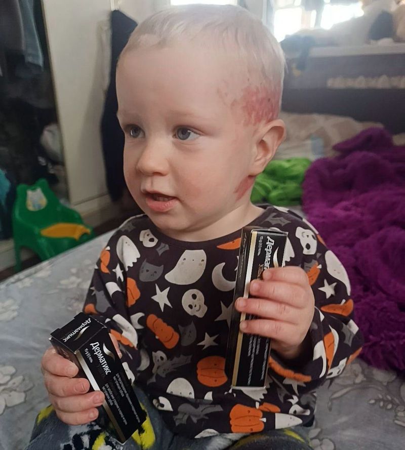 Мирон Брехер